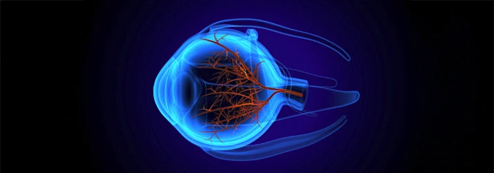 LASIK for Different Vision Conditions: Nearsightedness, Farsightedness and Astigmatism in Azusa CA